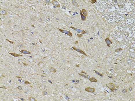 ADRBK2 Rabbit polyclonal antibody