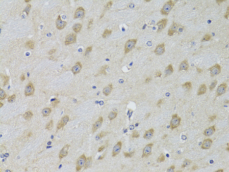 ADRBK2 Rabbit polyclonal antibody