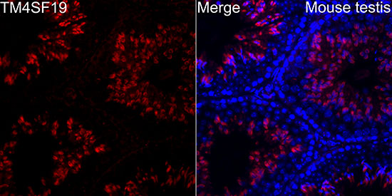 TM4SF19 Rabbit polyclonal antibody