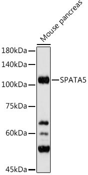 SPATA5 Rabbit polyclonal antibody
