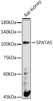 SPATA5 Rabbit polyclonal antibody