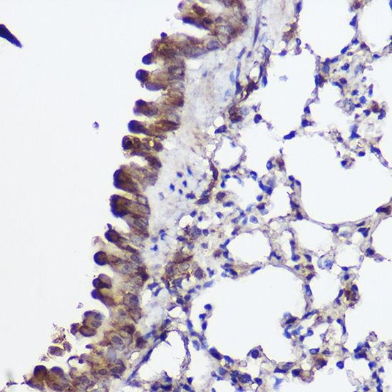 ABCA8A Rabbit polyclonal antibody