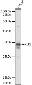 KLK3 Rabbit polyclonal antibody