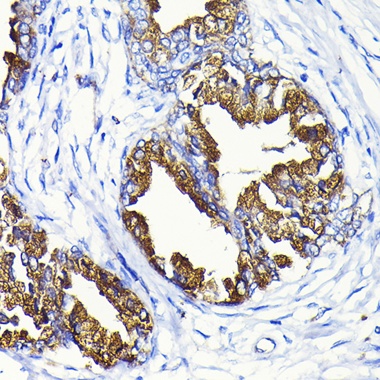 KLK3 Rabbit polyclonal antibody