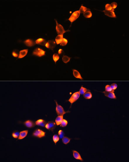 KLK3 Rabbit polyclonal antibody