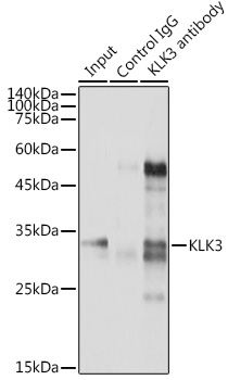 KLK3 Rabbit polyclonal antibody