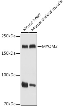 MYOM2 Rabbit polyclonal antibody