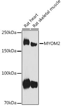 MYOM2 Rabbit polyclonal antibody