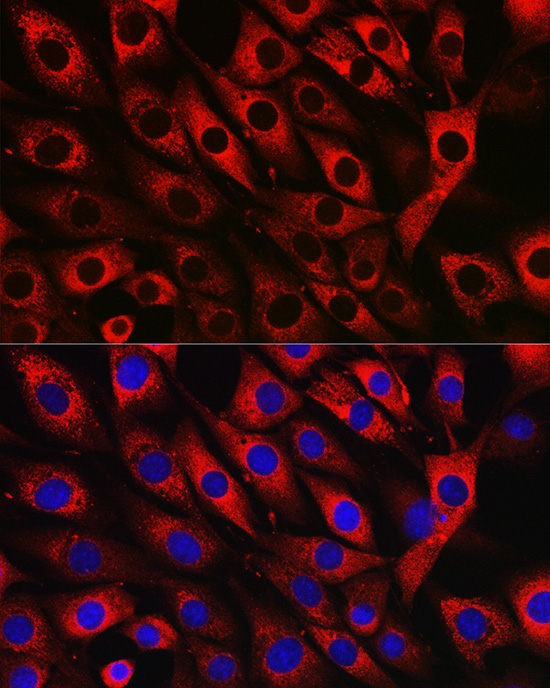 UFL1 Rabbit polyclonal antibody