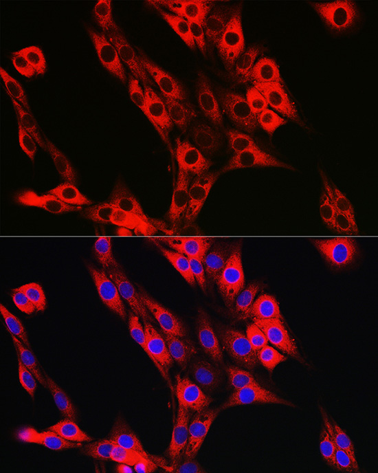 UFL1 Rabbit polyclonal antibody