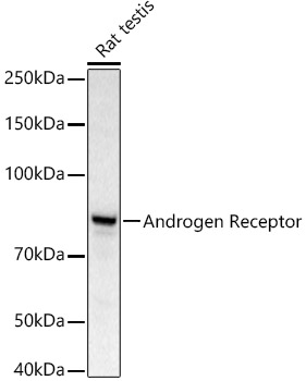 Androgen Receptor Rabbit polyclonal antibody
