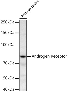 Androgen Receptor Rabbit polyclonal antibody