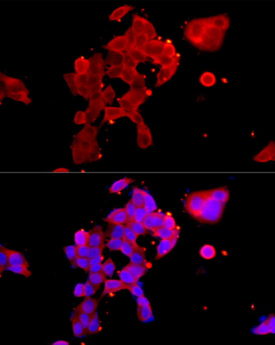 Androgen Receptor Rabbit polyclonal antibody
