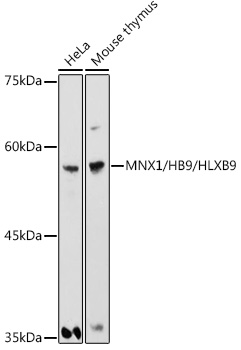 MNX1/HB9/HLXB9 Rabbit pAb