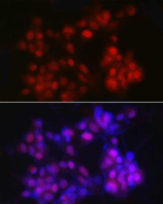 NKX3.1 Rabbit polyclonal antibody