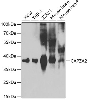 CAPZA2 Rabbit polyclonal antibody