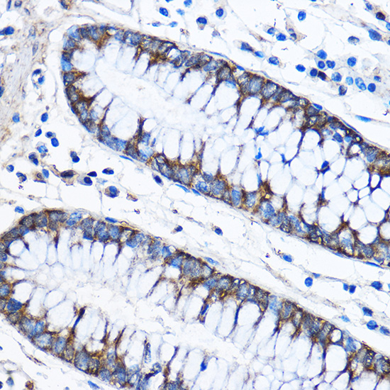 CAPZA2 Rabbit polyclonal antibody