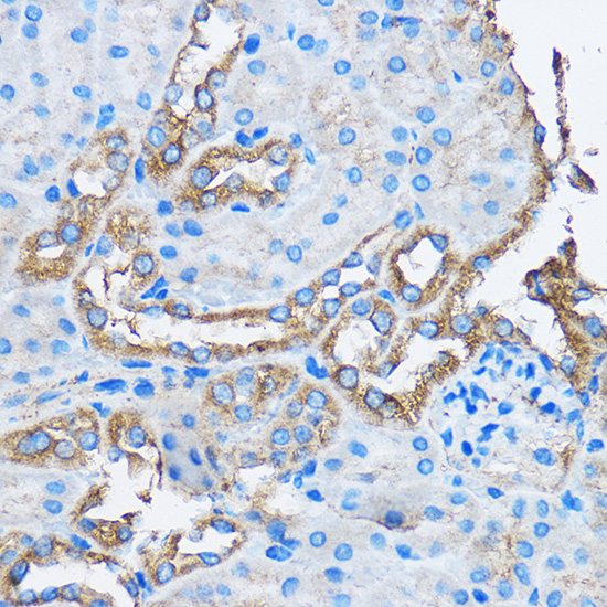 CAPZA2 Rabbit polyclonal antibody
