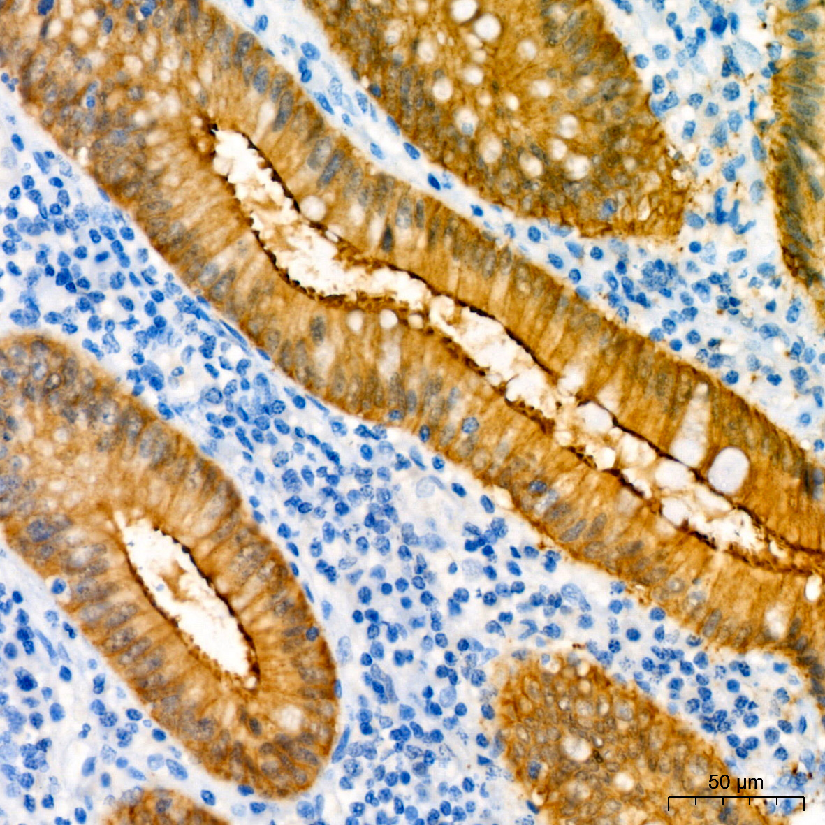 Villin1 Mouse monoclonal antibody