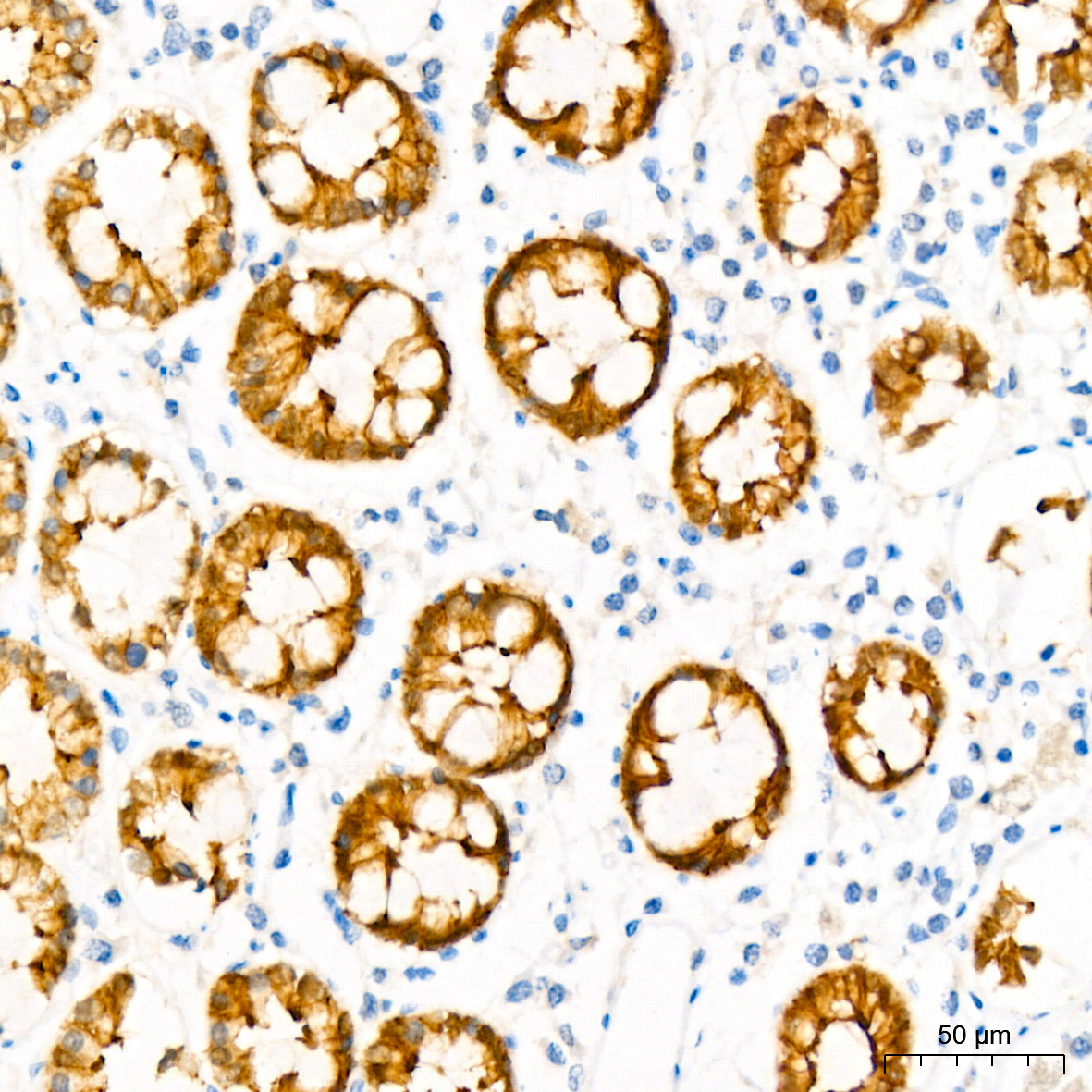 Villin1 Mouse monoclonal antibody