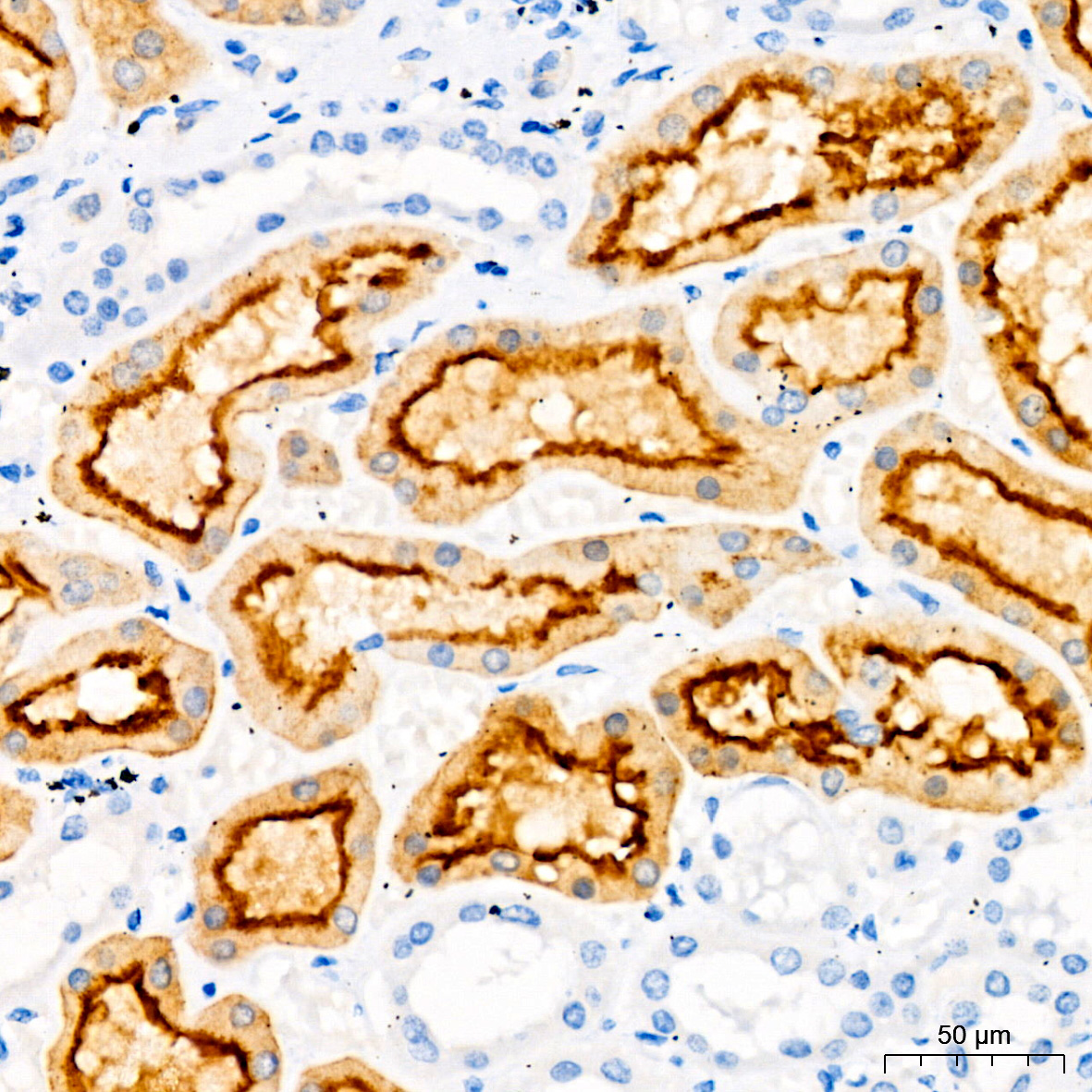 Villin1 Mouse monoclonal antibody