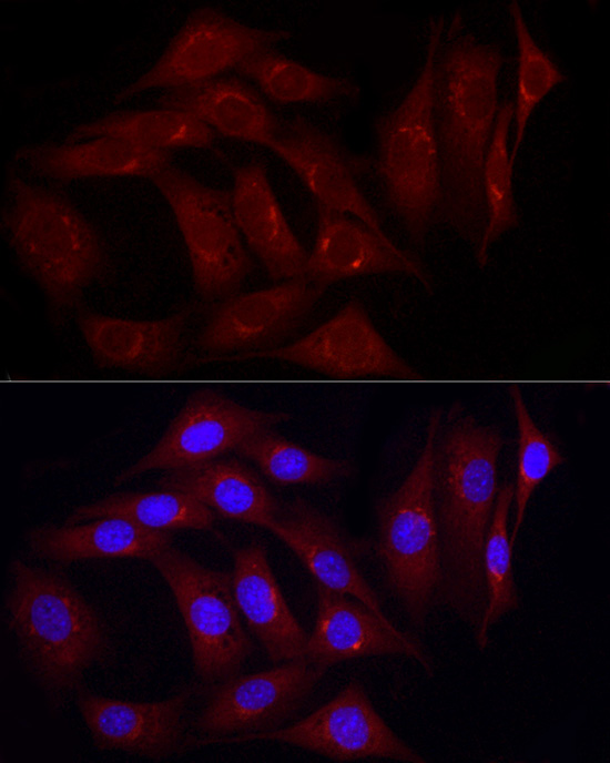 Caveolin-2 Rabbit polyclonal antibody