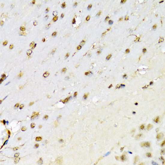 RUNX1 Rabbit polyclonal antibody