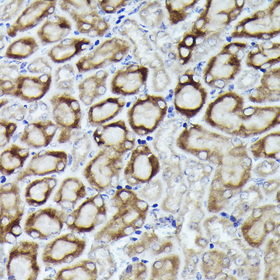 RPL19 Rabbit polyclonal antibody