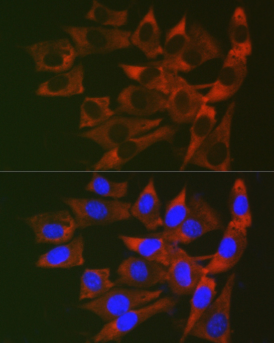 RPL19 Rabbit polyclonal antibody