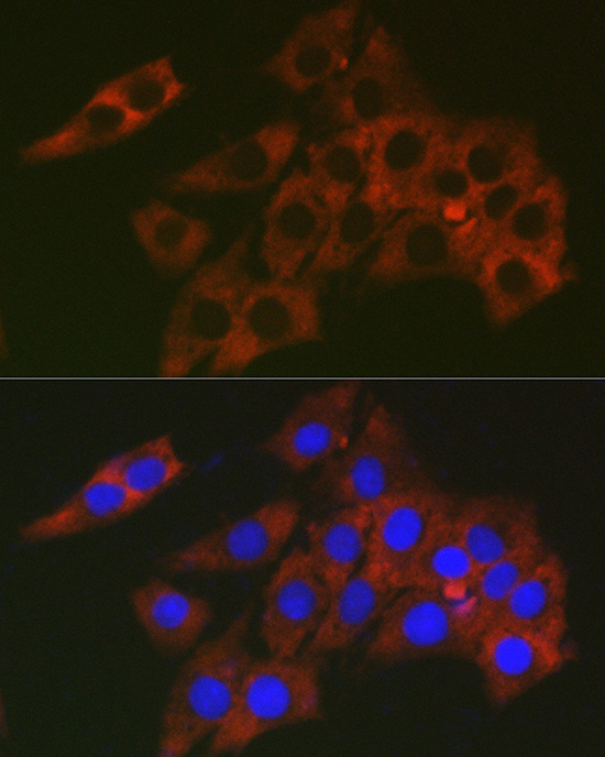 RPL19 Rabbit polyclonal antibody