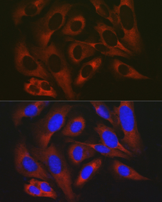 RPL19 Rabbit polyclonal antibody
