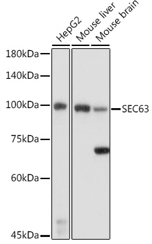 SEC63 Rabbit polyclonal antibody