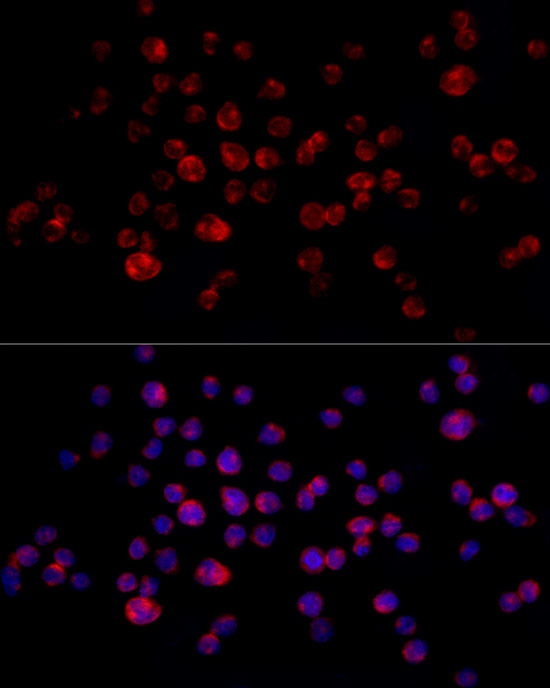 CD68 Rabbit polyclonal antibody