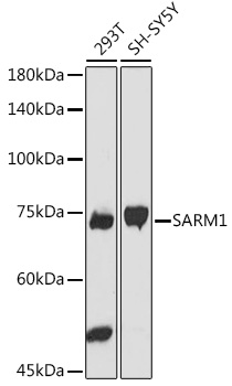 SARM1 Rabbit polyclonal antibody