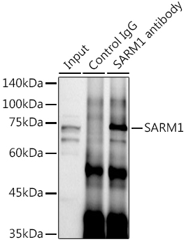 SARM1 Rabbit polyclonal antibody