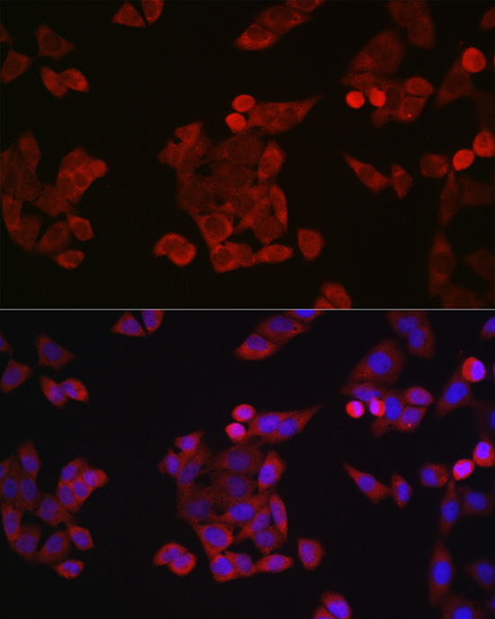 Cyclin B1 Rabbit polyclonal antibody