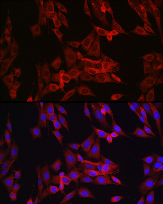 Cyclin B1 Rabbit polyclonal antibody