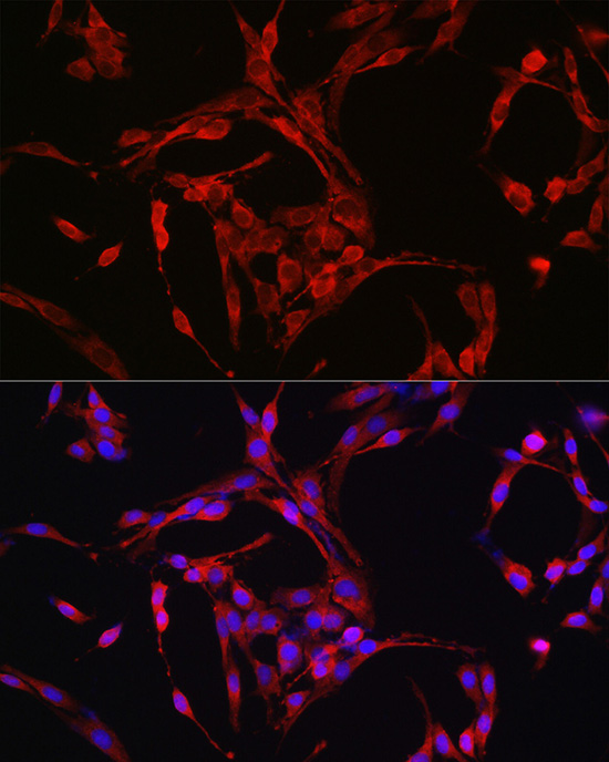 Cyclin B1 Rabbit polyclonal antibody