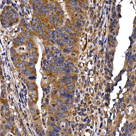 DYNC1LI2 Rabbit polyclonal antibody