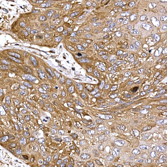 DYNC1LI2 Rabbit polyclonal antibody