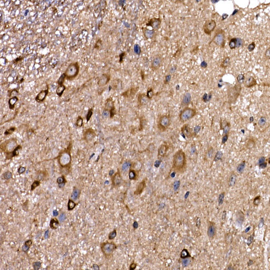 DYNC1LI2 Rabbit polyclonal antibody