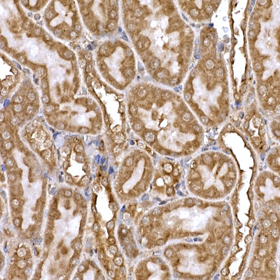 DYNC1LI2 Rabbit polyclonal antibody