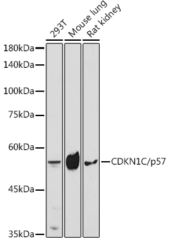 CDKN1C/p57 Kip2 Rabbit pAb