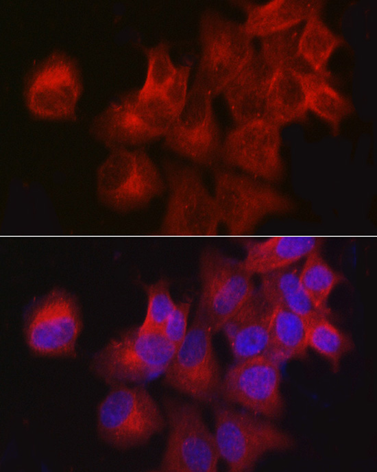 CDKN3 Rabbit polyclonal antibody