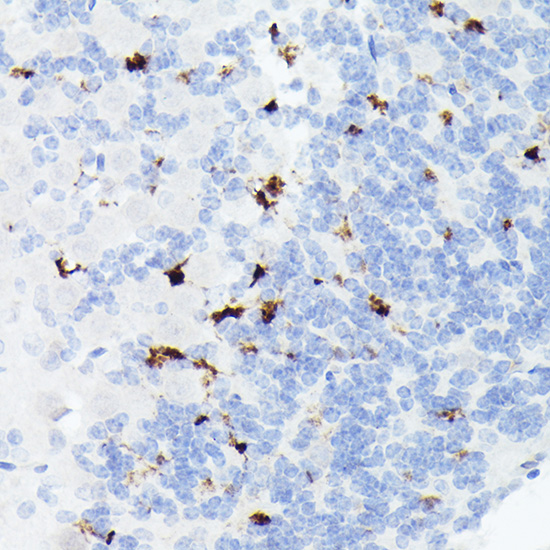 Somatostatin (SST) Rabbit monoclonal antibody