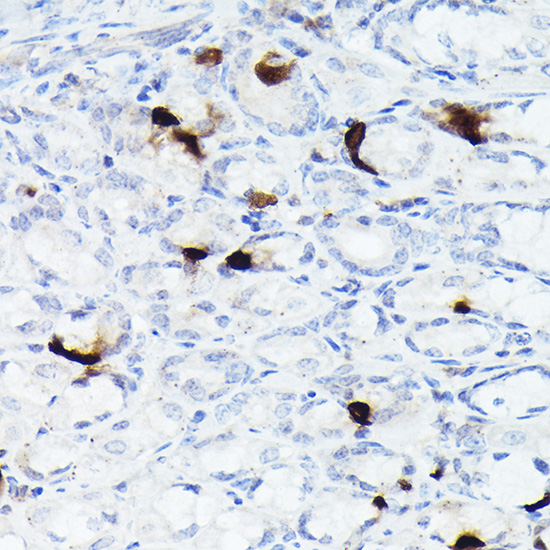 Somatostatin (SST) Rabbit monoclonal antibody