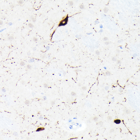 Somatostatin (SST) Rabbit monoclonal antibody