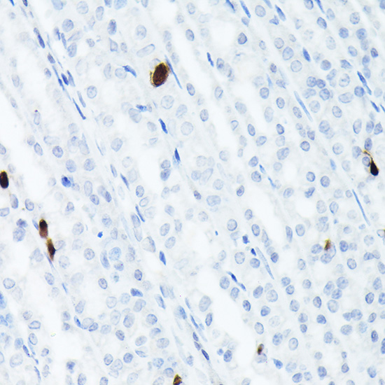 Somatostatin (SST) Rabbit monoclonal antibody