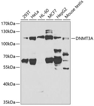 DNMT3A Rabbit polyclonal antibody