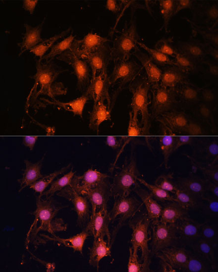 E2F1 Rabbit polyclonal antibody